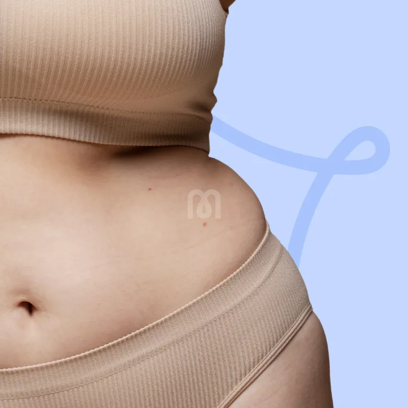 L’incontinence urinaire à l’effort