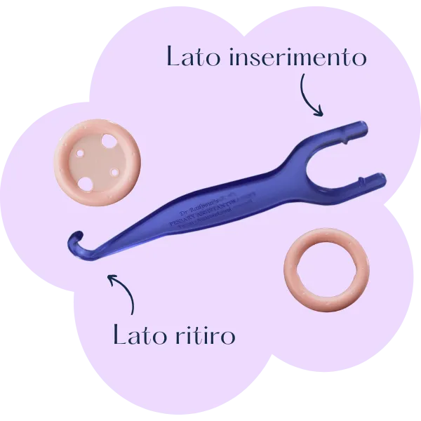 Pessario ad Anello Milex