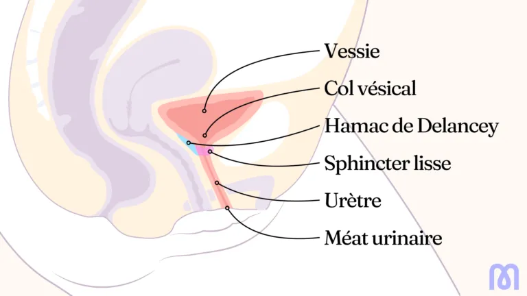 Quelles solutions pour les fuites urinaires ?